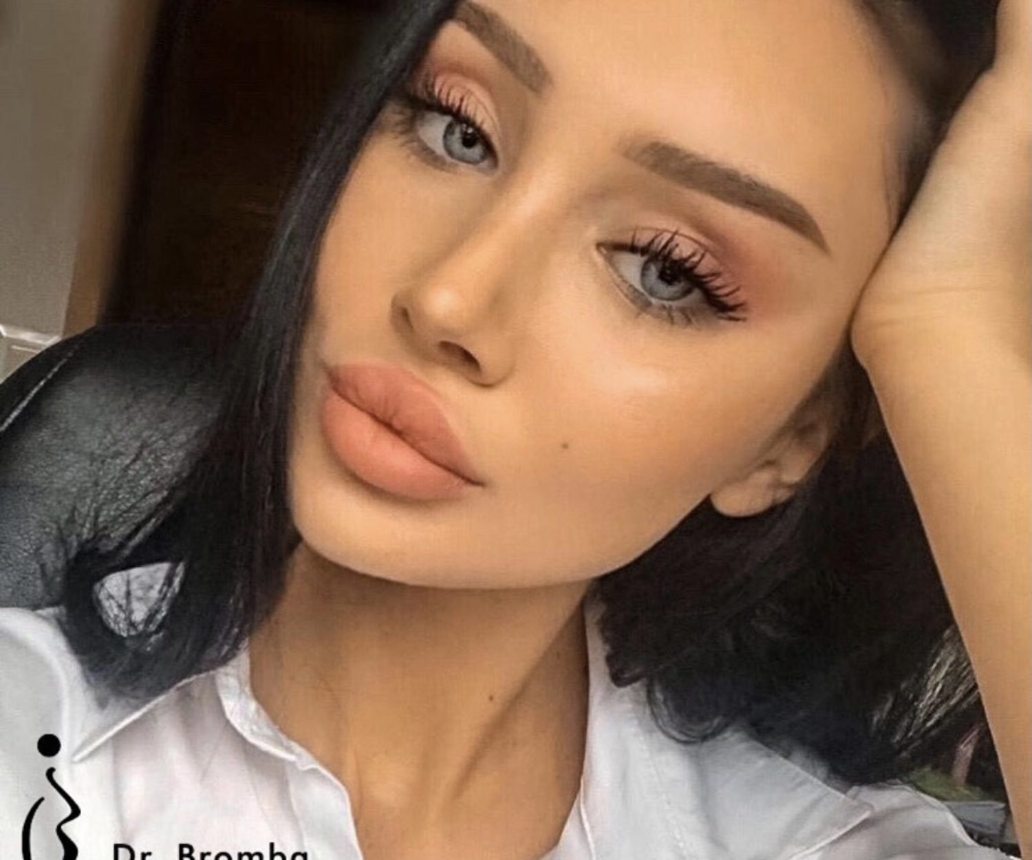 Nach der Nasenoperation durch Dr.Bromba